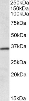 HOXA4 Antibody in Western Blot (WB)