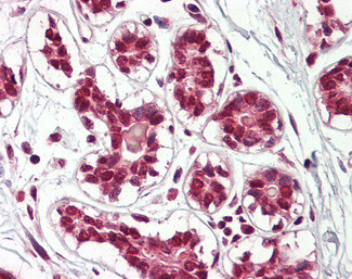 Cullin 2 Antibody in Immunohistochemistry (Paraffin) (IHC (P))