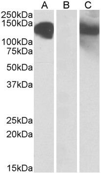 CDH11 Antibody in Western Blot (WB)