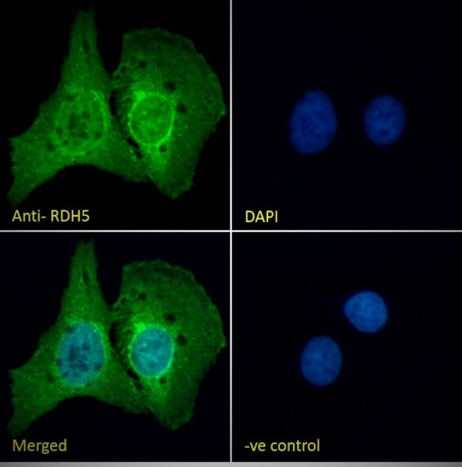 RDH5 Antibody in Immunocytochemistry (ICC/IF)