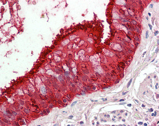 ALDH3A1 Antibody in Immunohistochemistry (Paraffin) (IHC (P))