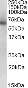 ALDH1B1 Antibody in Western Blot (WB)