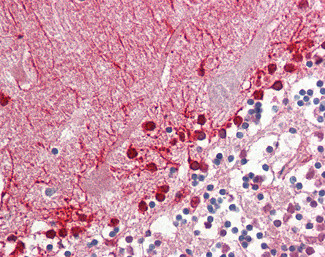 ALDH9A1 Antibody in Immunohistochemistry (Paraffin) (IHC (P))