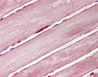 GLUT4 Antibody in Immunohistochemistry (Paraffin) (IHC (P))
