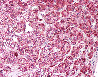 ETFA Antibody in Immunohistochemistry (Paraffin) (IHC (P))