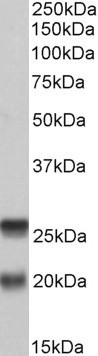 SNAP23 Antibody in Western Blot (WB)