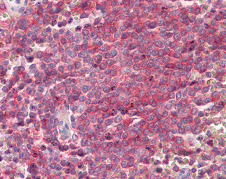 SNAP23 Antibody in Immunohistochemistry (Paraffin) (IHC (P))