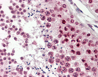 CIRBP Antibody in Immunohistochemistry (Paraffin) (IHC (P))