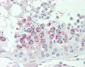 HAI-2 Antibody in Immunohistochemistry (Paraffin) (IHC (P))