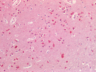 Ephrin B2 Antibody in Immunohistochemistry (Paraffin) (IHC (P))