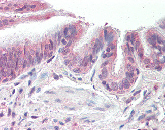 PSMB3 Antibody in Immunohistochemistry (Paraffin) (IHC (P))