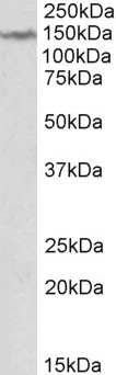 LMTK2 Antibody in Western Blot (WB)