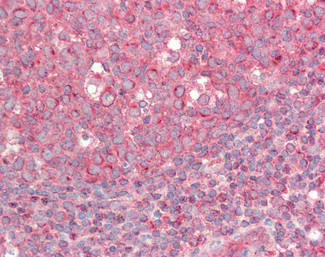 cIAP2 Antibody in Immunohistochemistry (Paraffin) (IHC (P))