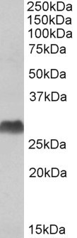 HLA-DQA1/DQA2 Antibody in Western Blot (WB)