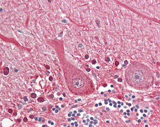 ARTS Antibody in Immunohistochemistry (Paraffin) (IHC (P))