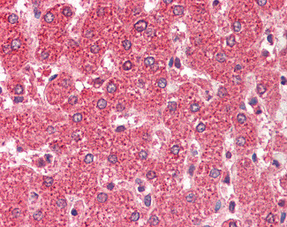 ALDH5A1 Antibody in Immunohistochemistry (Paraffin) (IHC (P))