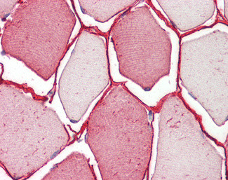 TRIM72 Antibody in Immunohistochemistry (Paraffin) (IHC (P))