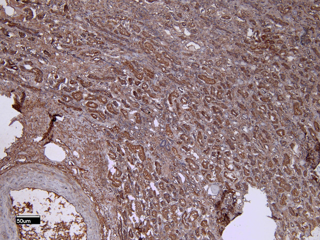 Dynactin 3 Antibody in Immunohistochemistry (Paraffin) (IHC (P))
