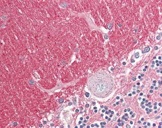 GNB3/GNB4 Antibody in Immunohistochemistry (Paraffin) (IHC (P))
