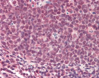 TMEM205 Antibody in Immunohistochemistry (Paraffin) (IHC (P))