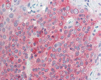 TMEM205 Antibody in Immunohistochemistry (Paraffin) (IHC (P))