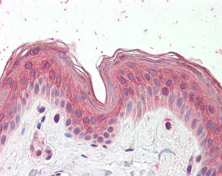 CYP24A1 Antibody in Immunohistochemistry (Paraffin) (IHC (P))