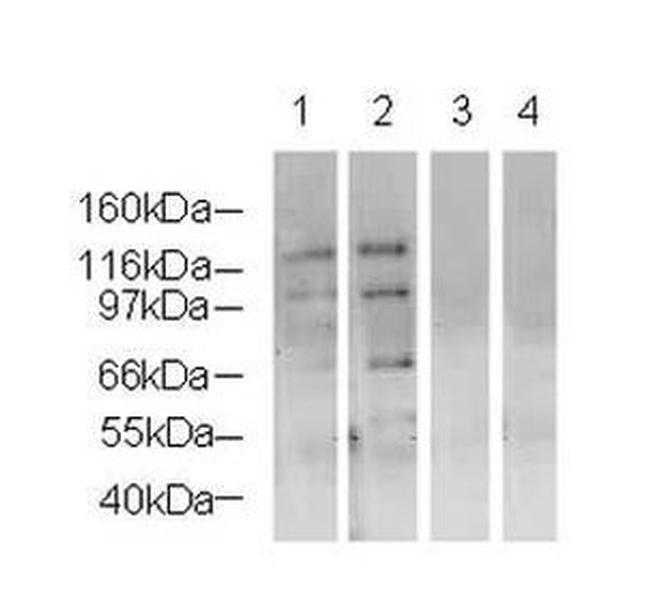 NSD3 Antibody in Western Blot (WB)