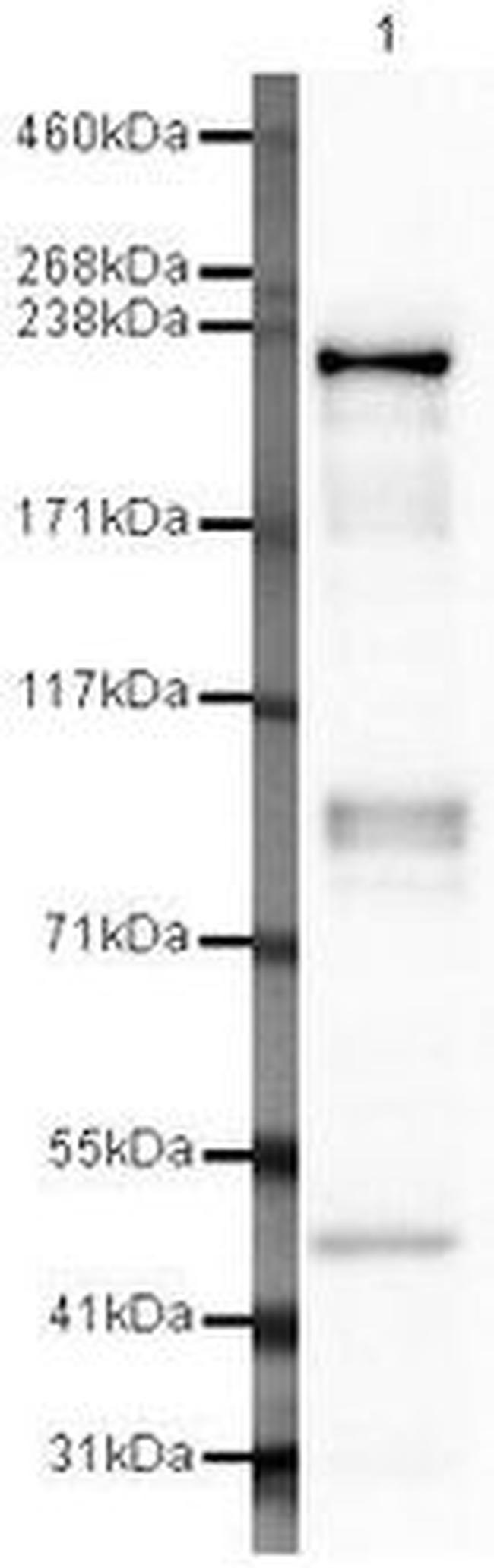 Dicer Antibody in Western Blot (WB)