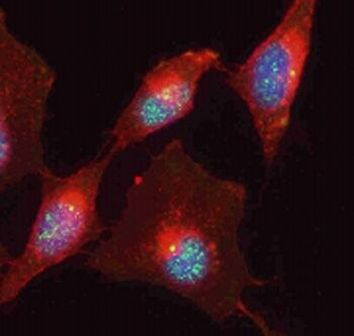MBD3 Antibody in Immunocytochemistry (ICC/IF)