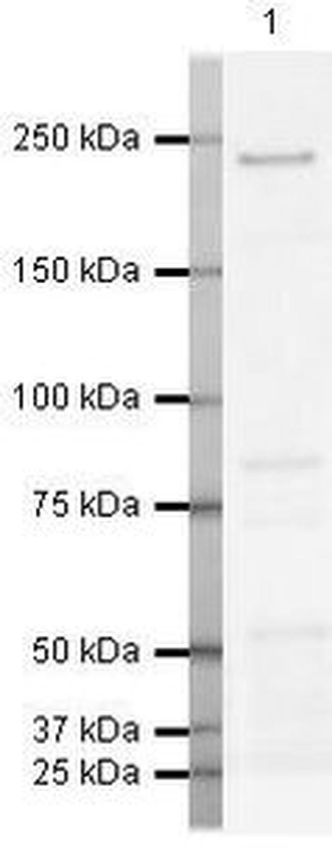 WRN Antibody in Western Blot (WB)