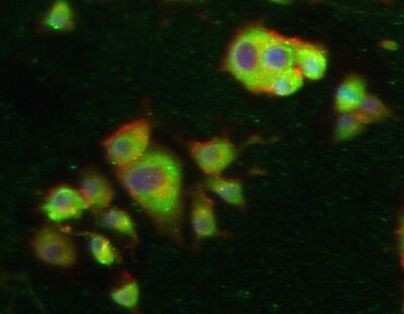 HIF-2 alpha Antibody in Immunocytochemistry (ICC/IF)