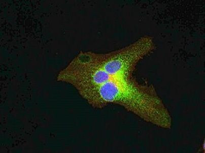 TSC1 Antibody in Immunocytochemistry (ICC/IF)