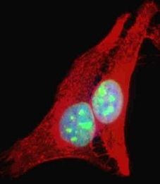 RECQ1 Antibody in Immunocytochemistry (ICC/IF)