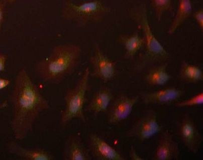 ASF1A Antibody in Immunocytochemistry (ICC/IF)