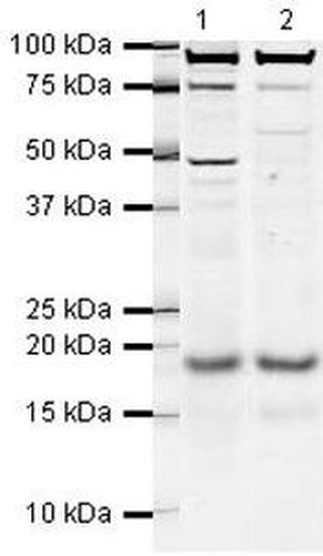 Stathmin 1 Antibody in Western Blot (WB)