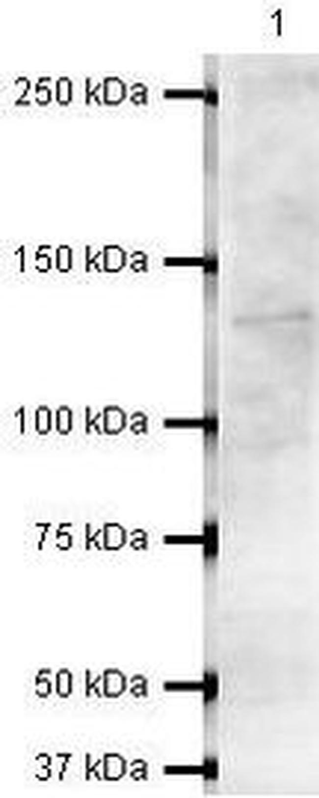 RNF40 Antibody in Western Blot (WB)