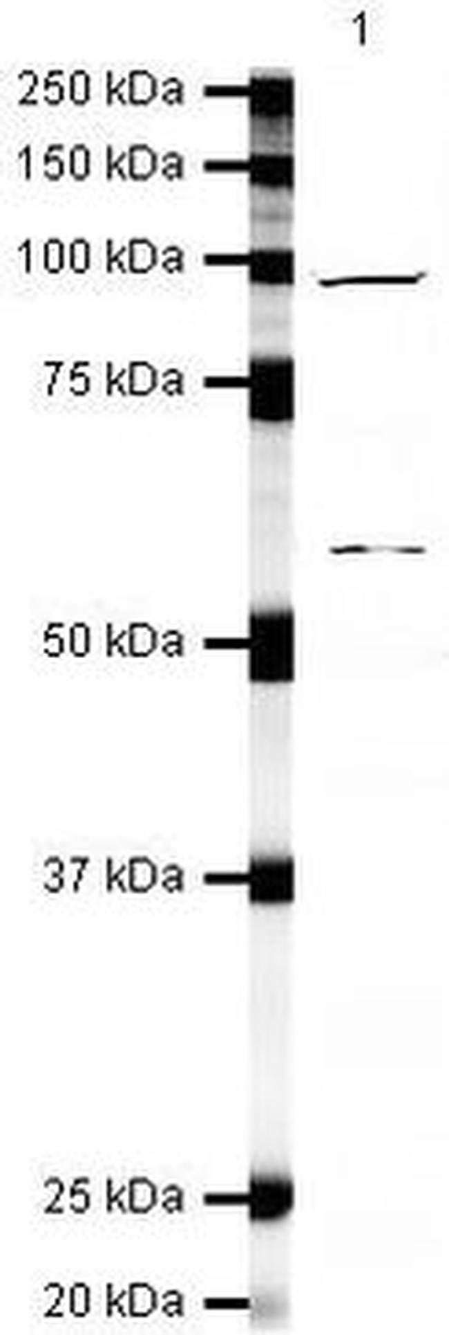 XPB Antibody in Western Blot (WB)