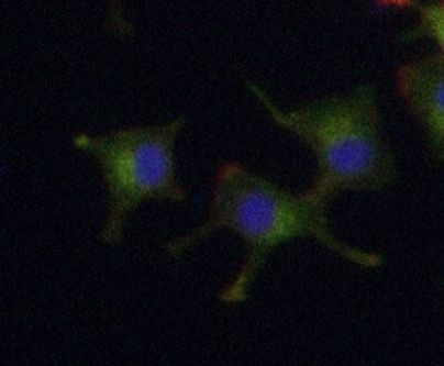 Doublecortin Antibody in Immunocytochemistry (ICC/IF)
