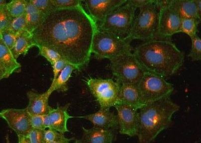 CCR10 Antibody in Immunocytochemistry (ICC/IF)