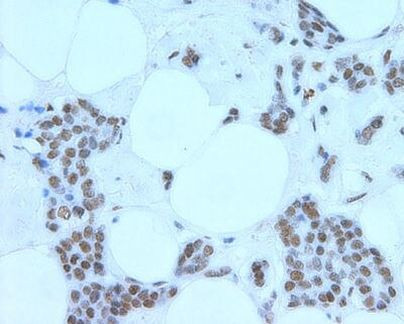 MRE11 Antibody in Immunohistochemistry (IHC)