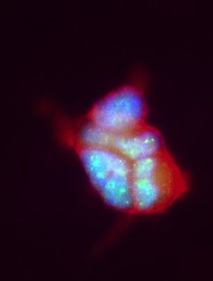 Menin Antibody in Immunocytochemistry (ICC/IF)