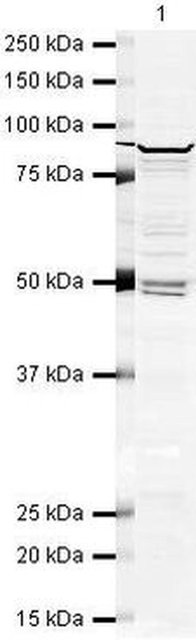 DDX1 Antibody in Western Blot (WB)