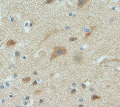 Netrin G1 ligand Antibody in Immunohistochemistry (IHC)