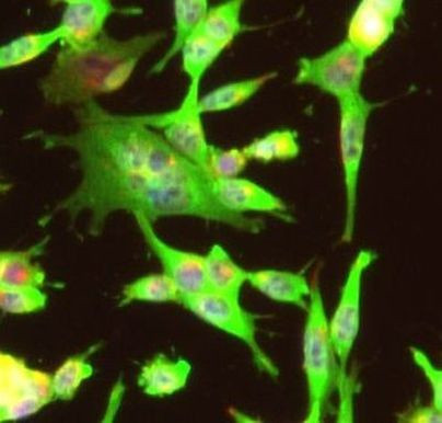 Gephyrin Antibody in Immunocytochemistry (ICC/IF)