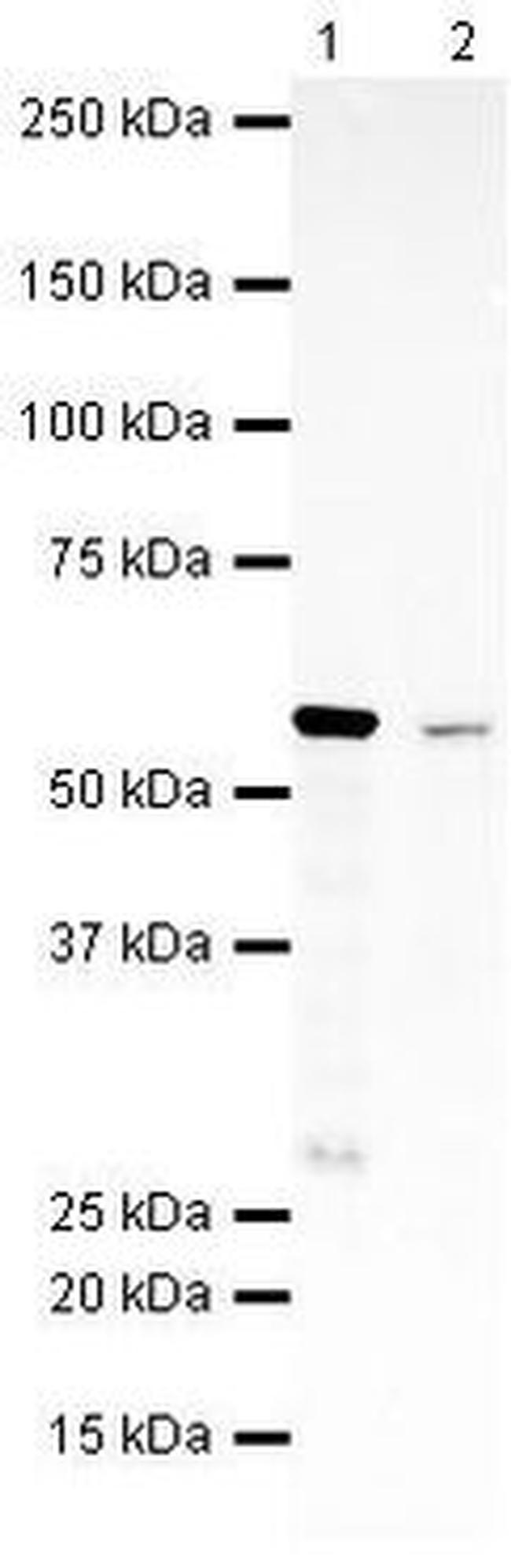 SMYD1 Antibody in Western Blot (WB)
