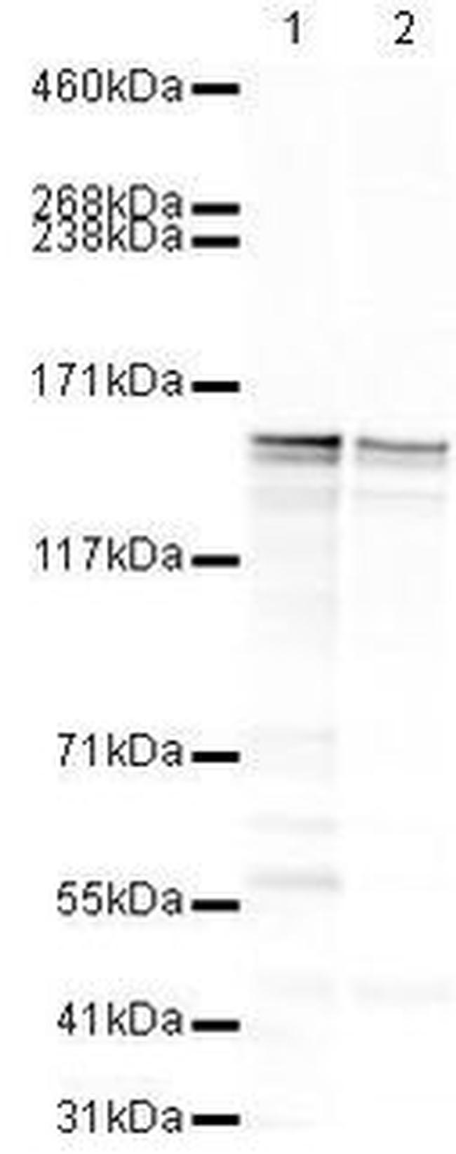 CAPS1 Antibody in Western Blot (WB)