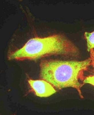 EEF2 Antibody in Immunocytochemistry (ICC/IF)