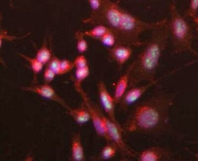 CENPA Antibody in Immunocytochemistry (ICC/IF)