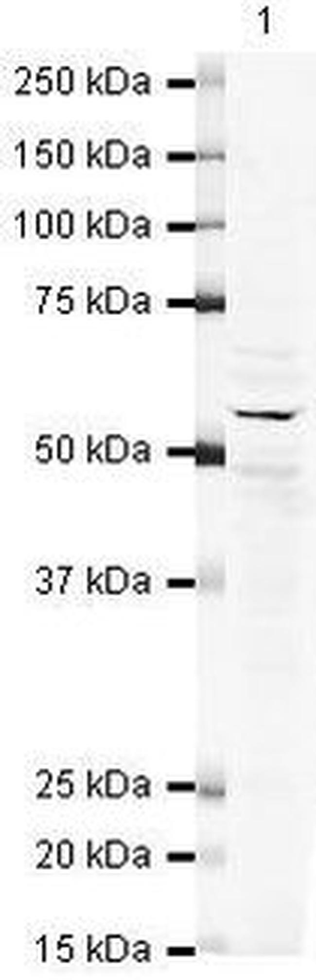 ETV1 Antibody in Western Blot (WB)