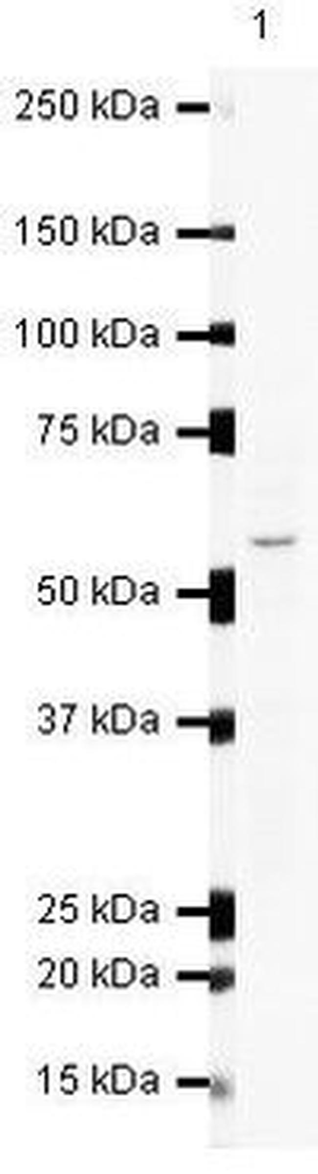 SMYD1 Antibody in Western Blot (WB)